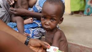 Nigerian State (Jigawa) Trains 600 Women to Tackle Child Malnutrition with Local Therapeutic Food